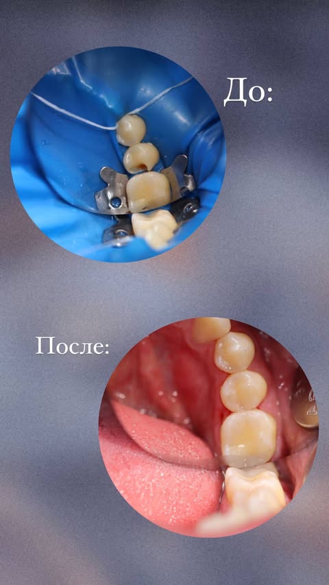 Результат лечения — до и после