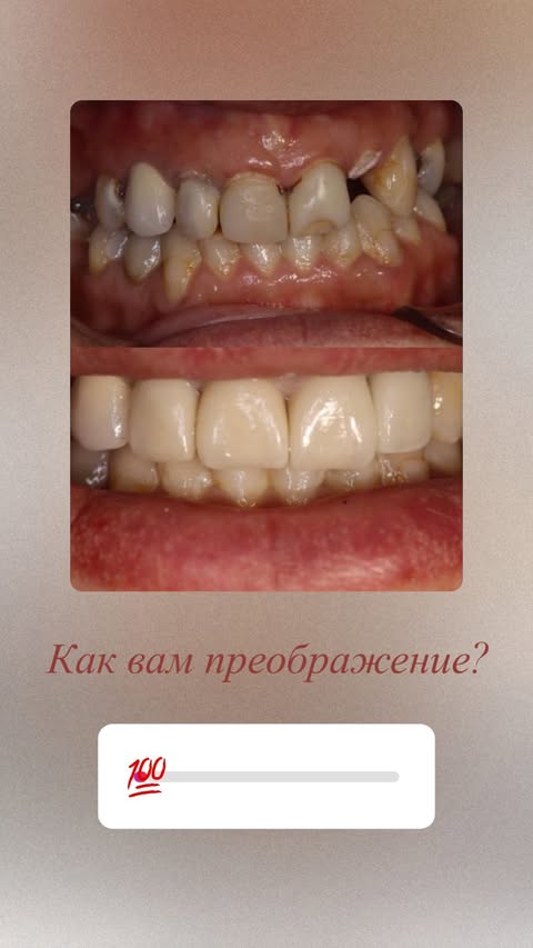 После лечения — восстановление