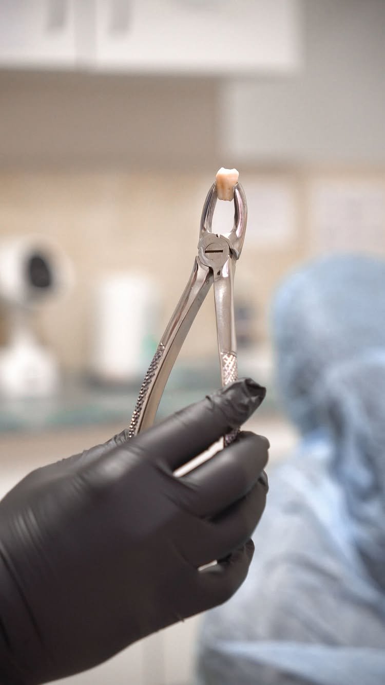 Лечение кариеса в клинике Статус Дента